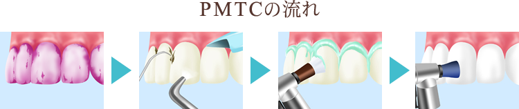 PMTCの流れ